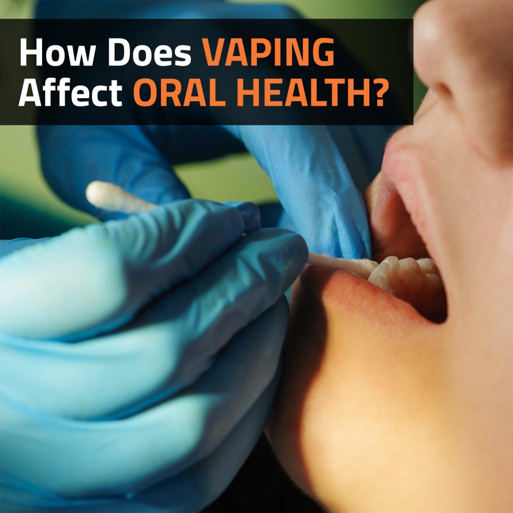 How Does Vaping Affect Oral Health