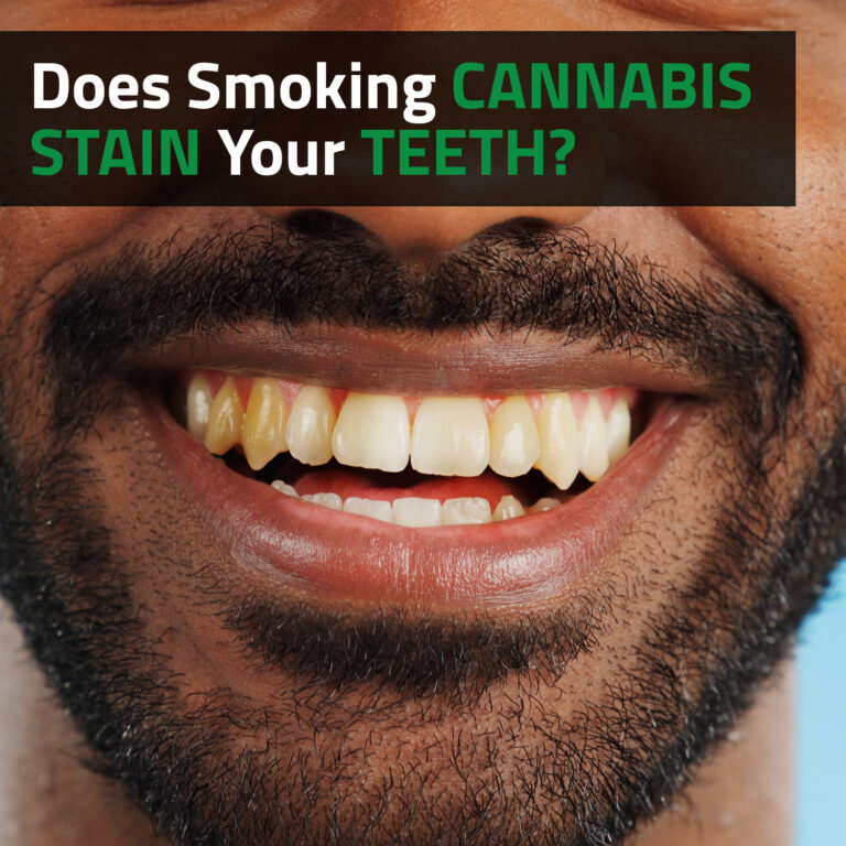 Does Smoking Cannabis Stain Your Teeth?